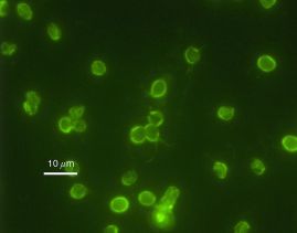 763px-Cryptosporidium_parvum_01