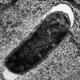 E__Coli_0157