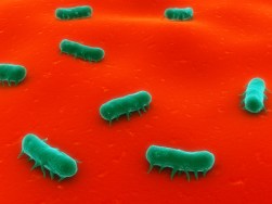 kswfoodworld salmonella