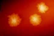 Clostridium_difficile_01
