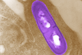kswfoodworld Listeria monocytogenes