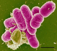 shigella