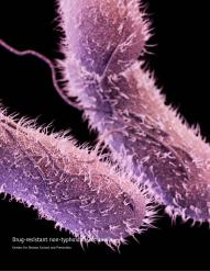 Food Poisoning Salmonella