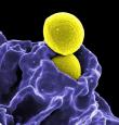 MRSA Staphylococcus KSW Food World