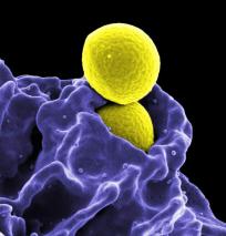 MRSA Staphylococcus KSW Food World